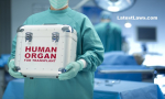 Transplantation of Human Organs