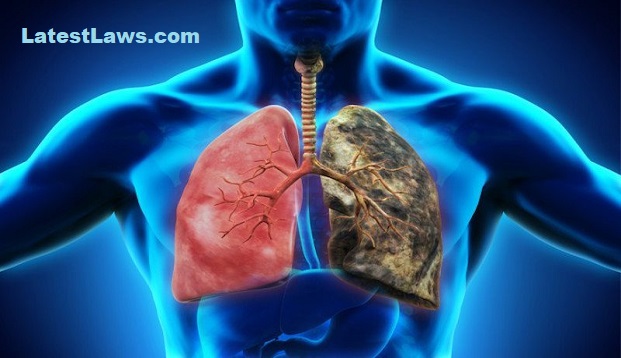 Smokers have Black Lungs & rest are PinkSmokers have Black Lungs & rest are Pink