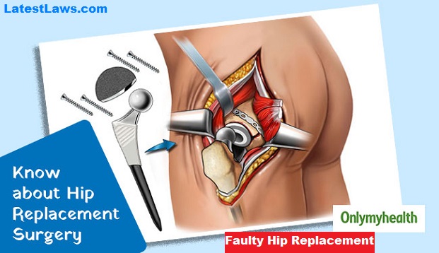 Faulty Hip Replacement Surgery