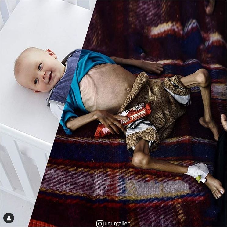 Our Future Nourished vs Starved - Two Worlds by Turkish Artist Uğur Gallenkuş