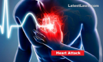 Heart Attack