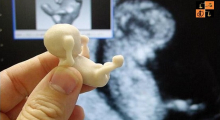 Abort Pregnancy of disabled girl (Pic by Google).jpg
