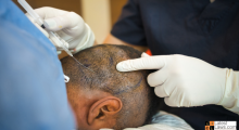 Hair Transplantation.png